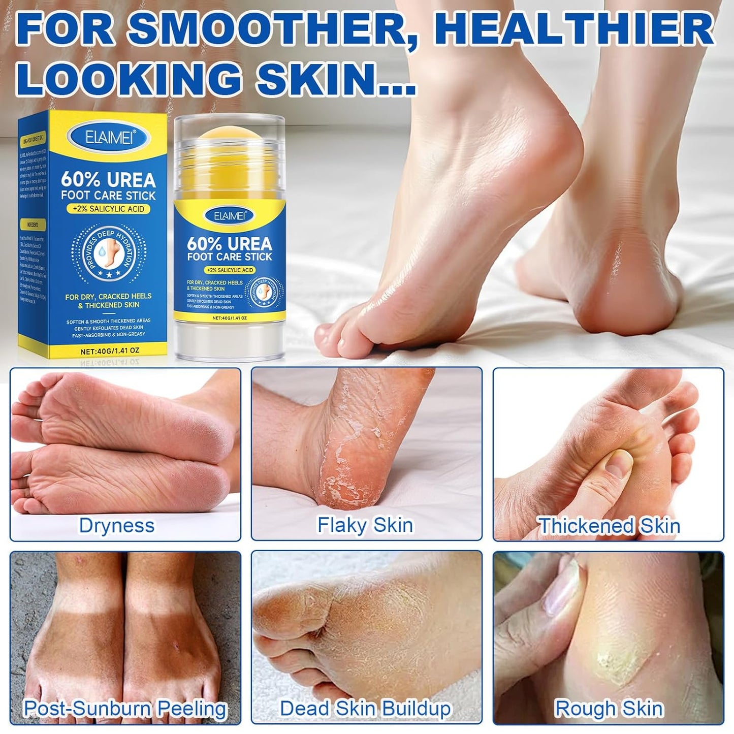 60% Urea with 2% Salicylic Acid Urea Foot Care Stick, Foot Cream Stick for Dry Cracked Heels, Feet Callus Remover, Hands Knees Exfoliating Dead Skin,Callus Remover & Skin Softener -1.41oz