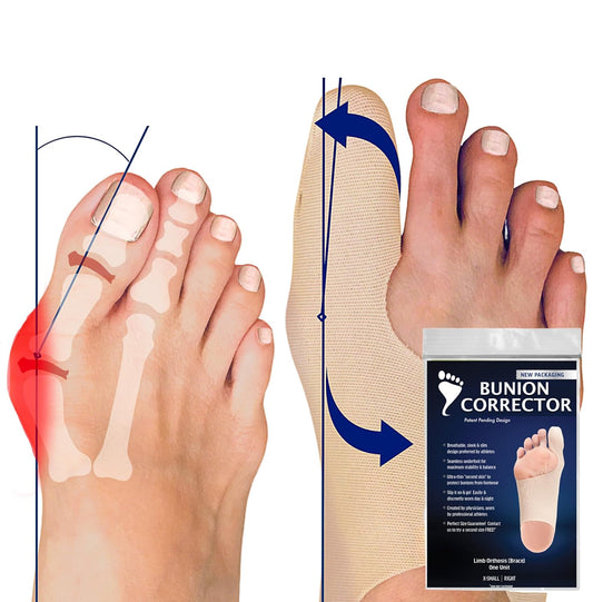 Bunion Corrector for Women Big Toe – Flexible Splint Straightener Sock – Ultra-Thin Bunion Relief Sleeve for All Shoe Types – For Hallux Valgus & Overlapping Toes. Small-Left