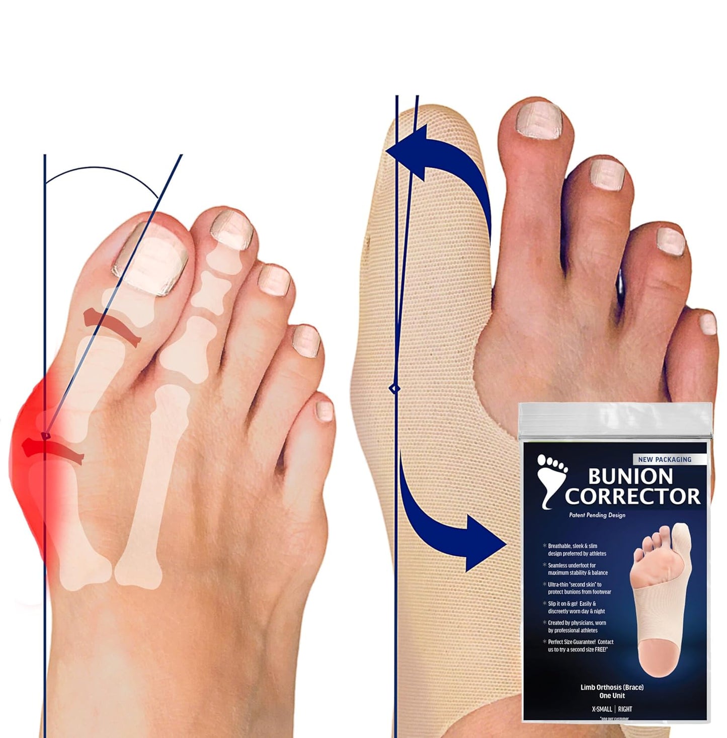 Bunion Corrector for Women Big Toe & Men – Ultra-Thin Toe Separator Sock for Pain Relief of Bunions – Flexible Hallux Valgus Splint That Easily Fits in Shoes – Great Toes Straightener. Med-Left