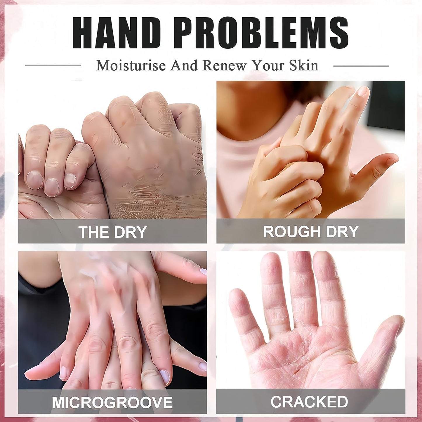 Roses & Milk Hand Repair Gloves, 5 Pairs Hydrating Hand Masks for Dry Cracked Hands, Moisturizing & Softening Gloves for Women & Men, Nourishing Hand Spa Treatment
