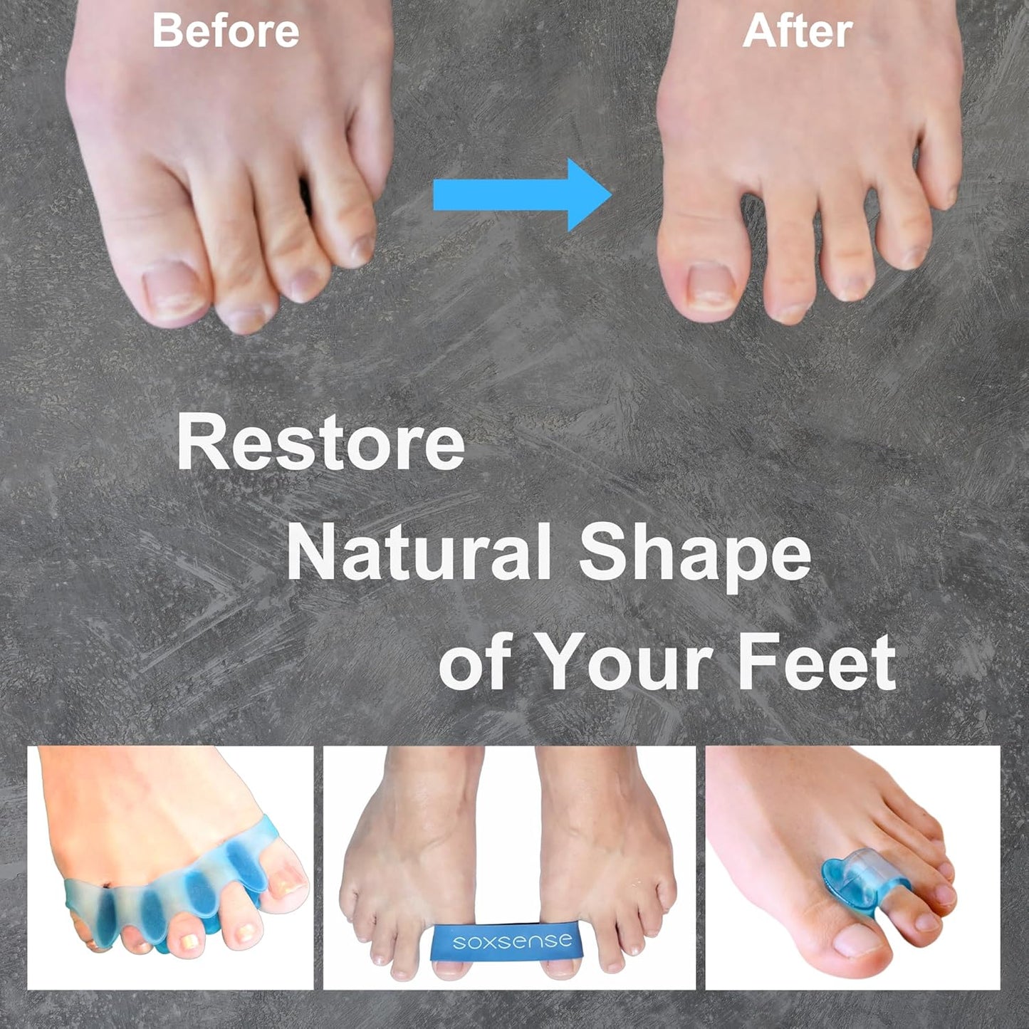 11 PCS Premium Set Bunion Corrector/Plantar Fasciitis Kit - Toe Exercise Bands and Separators for Women and Men